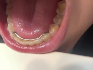 Retainer Mouth Closeup (PREVIEW)