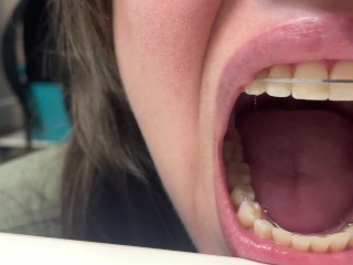 Retainer Mouth Closeup (PREVIEW)