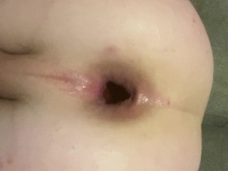 Close up big anal gape and self pissing. 🤤 MY ASS IS CUMMING FOR YOU anal milk squirt