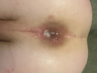 Close up big anal gape and self pissing. 🤤 MY ASS IS CUMMING FOR YOU anal milk squirt
