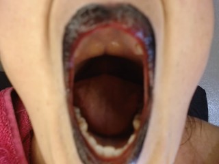 Anna Yawning Over and Over Big Wide Open Mouth Teary Eyed Tired