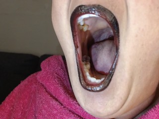 Anna Yawning Over and Over Big Wide Open Mouth Teary Eyed Tired