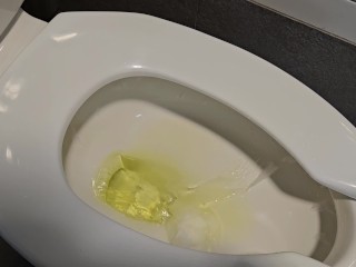 Do You Prefer Urinals Or Toilets?