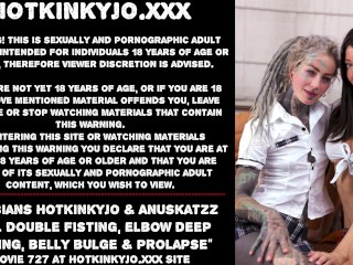 Lesbians Hotkinkyjo & Anuskatzz anal double fisting, elbow deep fisting, belly bulge & prolapse