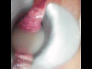 POV Cum Injection in My Cervix Ensuring Proper Fertilization of Your Sperm