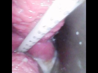 POV Cum Injection in My Cervix Ensuring Proper Fertilization of Your Sperm