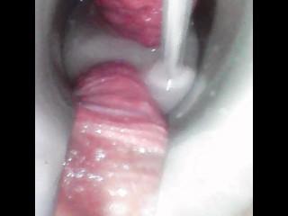 POV Cum Injection in My Cervix Ensuring Proper Fertilization of Your Sperm