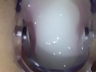 Spreading my pussy open with a speculum and filling it with fake cum until it's full