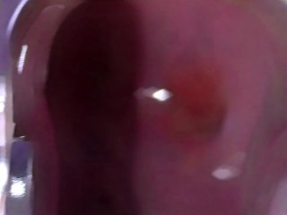 Spreading my pussy open with a speculum and filling it with fake cum until it's full