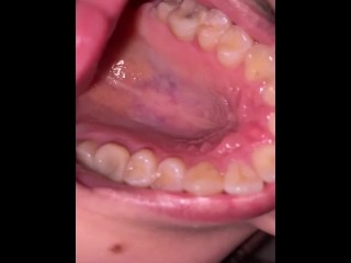 Mouth tour. Uvula and teeth 