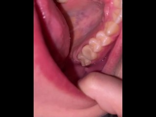 Mouth tour. Uvula and teeth 