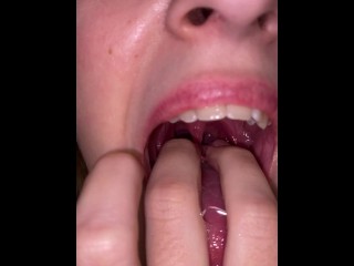 Old video without my braces