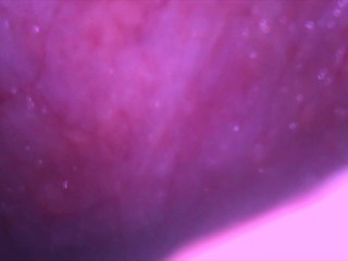 Eating The Ex For Xmas Full Video