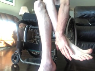 Pasty white numb legs of a paraplegic 