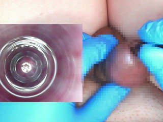 【閲覧注意】10mmの試験管に内視鏡を入れて尿道内の観察をしてみました。(主観視点＋内視鏡映像)