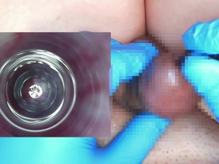 【閲覧注意】10mmの試験管に内視鏡を入れて尿道内の観察をしてみました。(主観視点＋内視鏡映像)