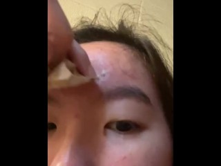 popping pimple :)