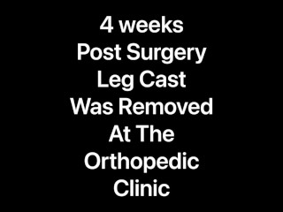 Leg Cast Was Removed At The Orthopedic Clinic Today, Staples Removed, & Provided With A Leg Boot