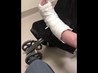 Leg Cast Was Removed At The Orthopedic Clinic Today, Staples Removed, & Provided With A Leg Boot
