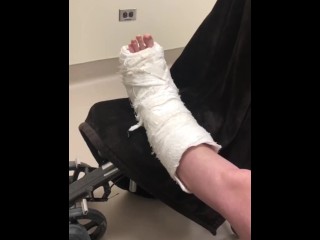 Leg Cast Was Removed At The Orthopedic Clinic Today, Staples Removed, & Provided With A Leg Boot