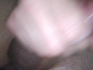 Blue balls & razer burn, ouch! 