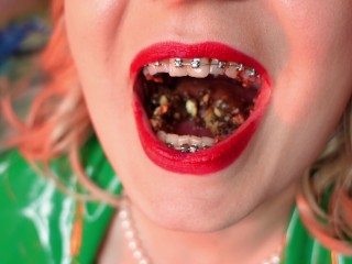 food fetish - eating blowing candy - ASMR video of chewing girl in BRACES with all sounds close up