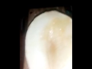 moiprat do you like melon