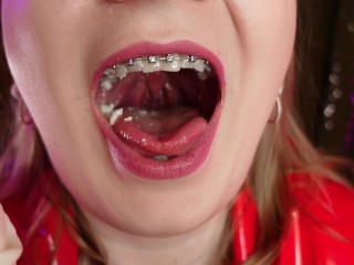 mukbang ASMR eating video FOOD FETISH in braces