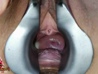 Speculum deep insights into my PUSSY - Claary Cherry
