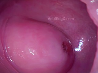 Cervix Throbbing After Orgasm and Heart Beating