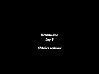 Circumcision day #9 👍