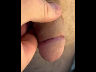 Circumcision day #9 👍