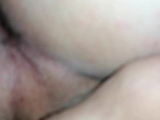 Passage chez l'esthéticienne épilation au laser maillot testicule inter fessiers, c'est du propre