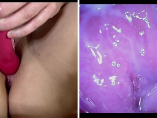 Stella Puts a Camera Inside Her Vagina After a Creampie Gangbang - Raw Footage Inside of Pussy