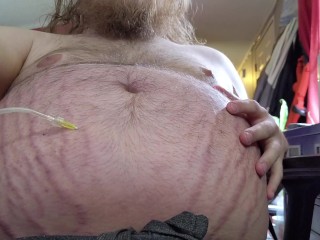 Sitting N2O Belly Inflation