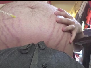 Sitting N2O Belly Inflation