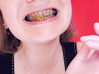 ASMR braces: giantess vore, eating jelly bears, chewing and swallowing, mouth fetish, Arya Grander