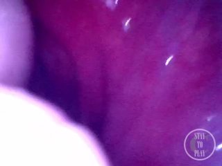 Endoscope inside POV of my juicy Ass getting fisted deeply - Preview