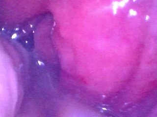 Endoscope inside POV of my juicy Ass getting fisted deeply - Preview