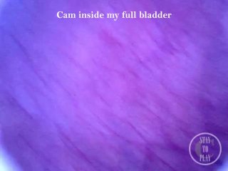 Pumping Air into my full Bladder with the Minicam inside - Preview