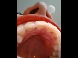 Vore debora POV- endoscope