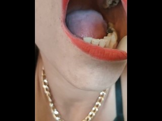 medical throat examination for a french sex worker