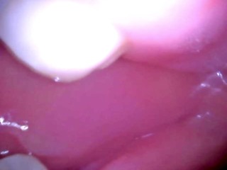 Inside my mouth with braces