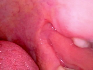 Inside my mouth with braces