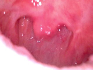 Inside my mouth with braces