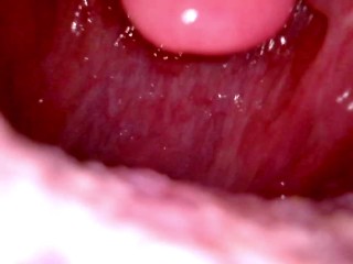 Inside my mouth with braces