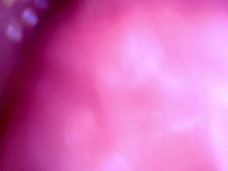 Inside my mouth with braces