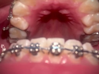 CUM IN MY BRACES