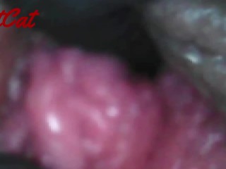 Endoscopic ♥vaginal observation内視鏡おまんこ♥膣内観察