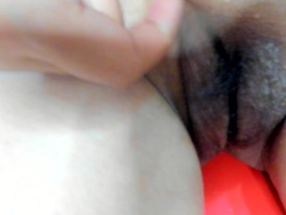 日本人女性の大陰唇から大量のフケ。ピルを飲んで生理が１か月以上続きかぶれたせいです(´;ω;｀)
